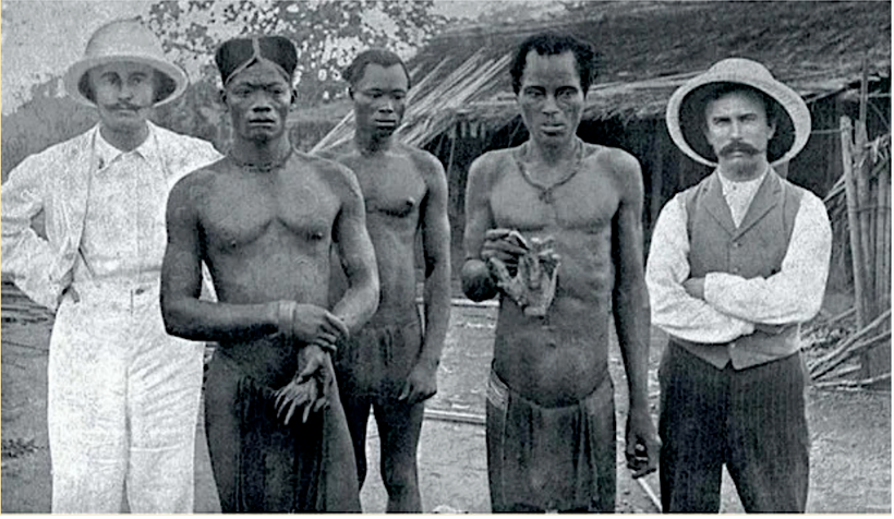 EIC- Congolais exposant des mains coupée